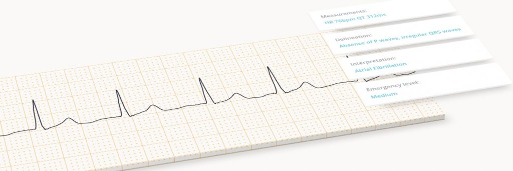 Logo de la startup Cardiologs recrute un/e Data Scientist